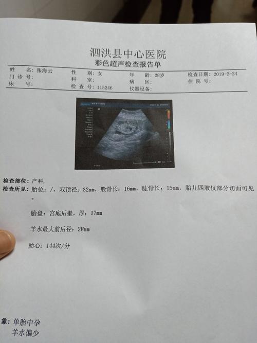 第一次的产检报告和四个月的报告,可以看出男女吗?