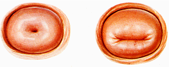 宫颈分为前唇和后唇,是解剖学上的位置关系图