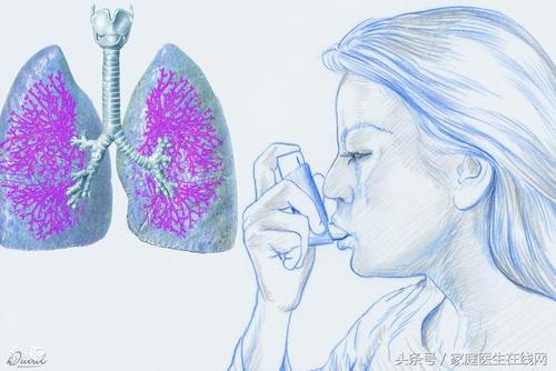 支气管扩张剂,主要有这3种常见的药物!快速收藏