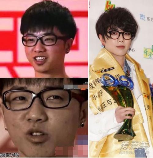 华晨宇是不是整容了?近照皮肤雪白有点不同