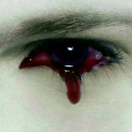 求:和这张图片类似的图片 ~ 流血的眼睛