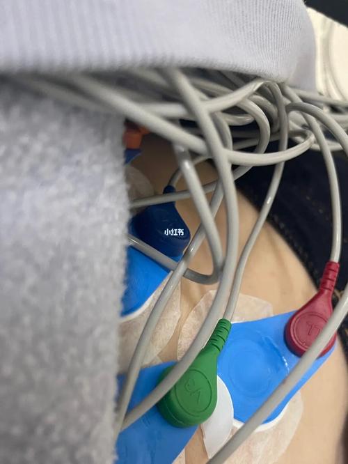 心脏不舒服,带上了24小时心电图_心脏_医疗健康_医疗