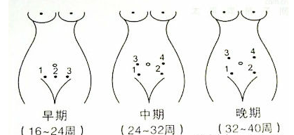 孕妇怎么听胎心如何正确听胎心