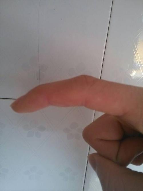 阴茎勃起的时候是往下弯曲的!而且还有点往