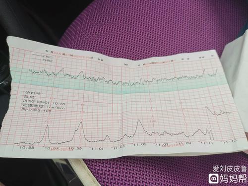 前几天生气,宫缩多了!今天做胎心监护抓到