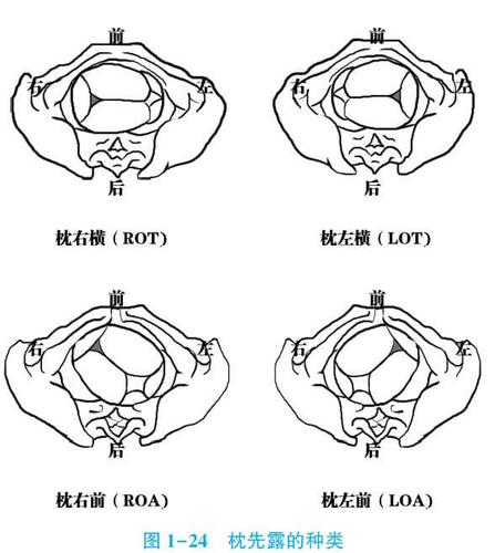 医学教育网 临床助理医师 辅导精华 > 正文*确定胎方位的方式:临床上