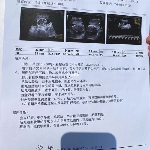 nt很多人看了说是男宝我心好痛_nt检查_母婴_孕产经验