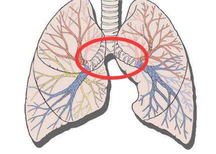 主支气管示意图