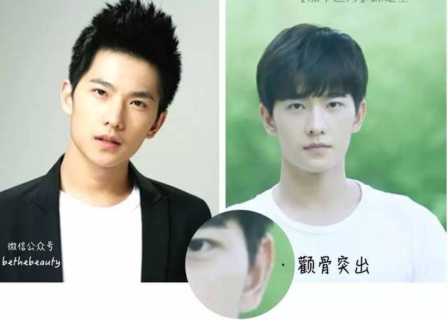 他还有一个(我不说你应该不会注意到的)骨相问题: 颧骨突出!