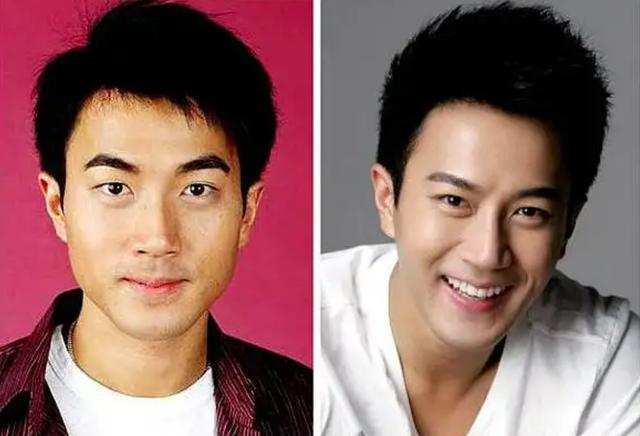 8位改头换命的男明星王一博脸已僵硬刘恺威眼皮才是灵魂