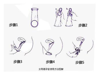 女用避孕套的正确使用方法