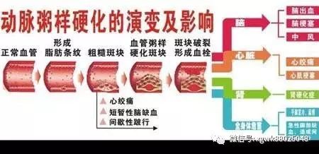 下肢动脉硬化闭塞症的治疗方法有哪些?