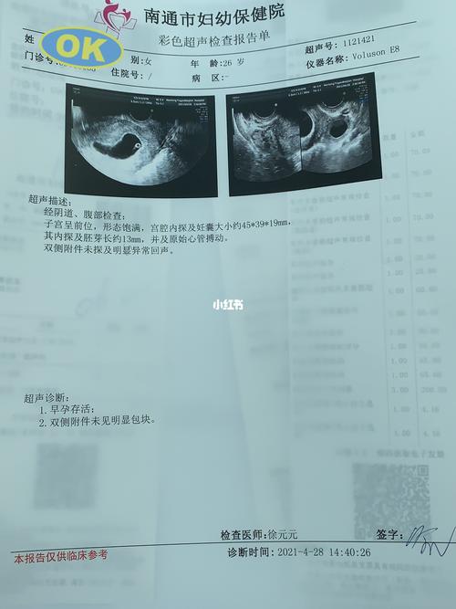 孕8周啦_孕期_nt检查_四维彩超_孕期日常_母婴_孕产