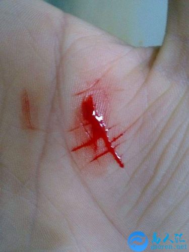 梦见手流血是什么意思?有什么预兆?