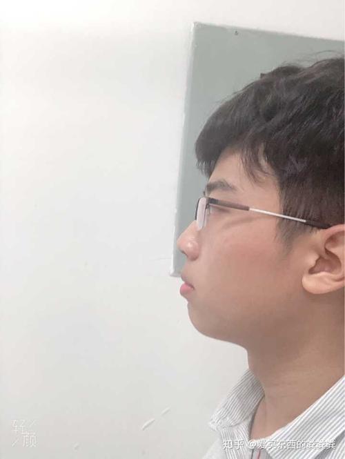 侧脸丑而正脸好看是一种什么体验