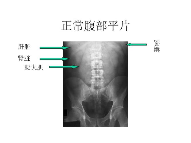 ppt 155页