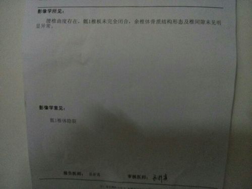 说骶1椎体隐裂,是怎么回事?最近正在减肥,能做什么运动?