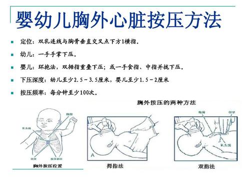 心肺复苏课件ppt