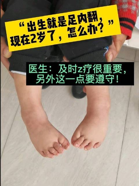 出生就是足内翻现在2岁了怎么办