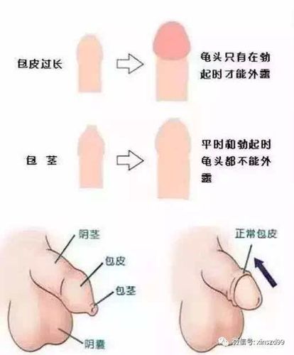 来自一位父亲的忠告:别再乱动小男孩的那块皮!