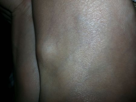 脚背上鼓起来的是什么,是硬的