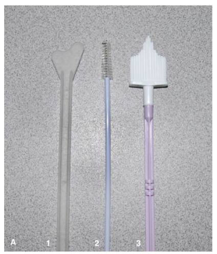 制片和阅片方法,通常与hpv联合检测用于宫颈癌筛查,属于"宫颈癌三阶梯