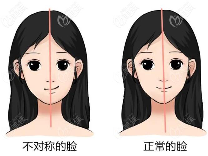 大小脸,错颌畸形?结果可能更