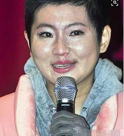 任家萱:谈及烧伤哽咽难言,她的勇敢是没有选择性的