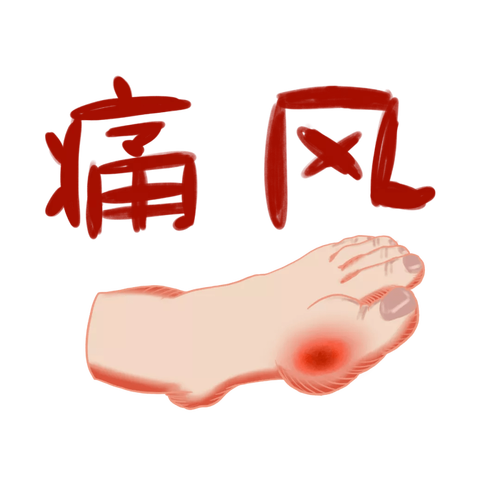 痛风急性发作的6大误区