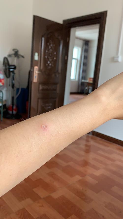 讨论能帮我看看这是猫癣吗人得的更新