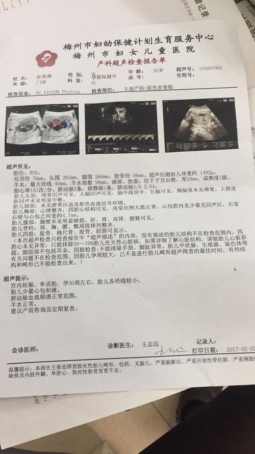 图片怀孕33周胎儿真实图片30周胎儿图片胎儿心包积液孕33周胎儿真实图