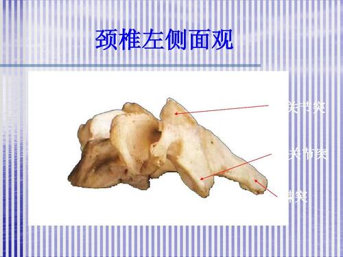 颈椎病应用解剖2ppt