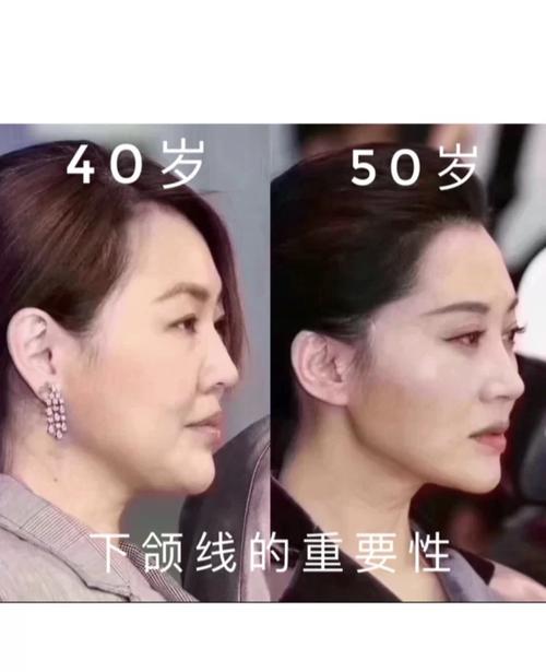 下颌线清晰流畅 人看起来就会年轻精致,区别真太明显了 所以抗衰一定