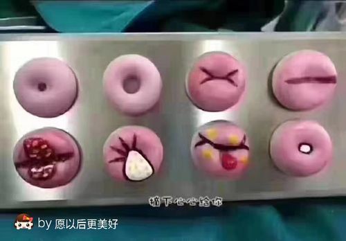 1,少女健康宫颈 2,生产后健康宫颈 3,宫颈撕裂  4,生育后上环的宫颈 5