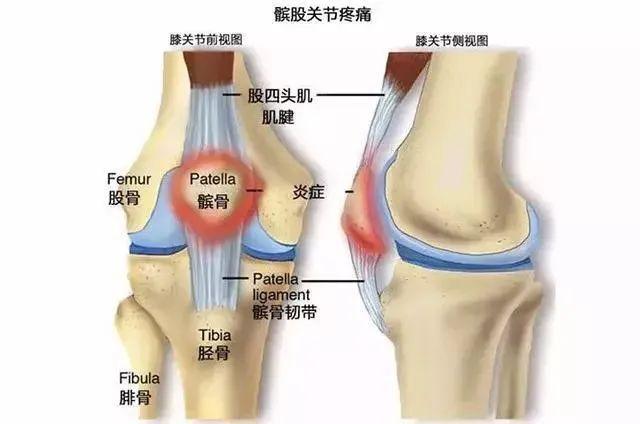 髌骨的主要作用是增加股四头肌的力臂,减少运动中相对组织的摩擦,提高