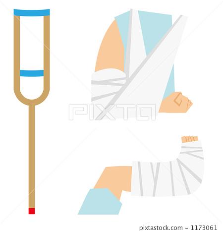 插图素材: 骨折