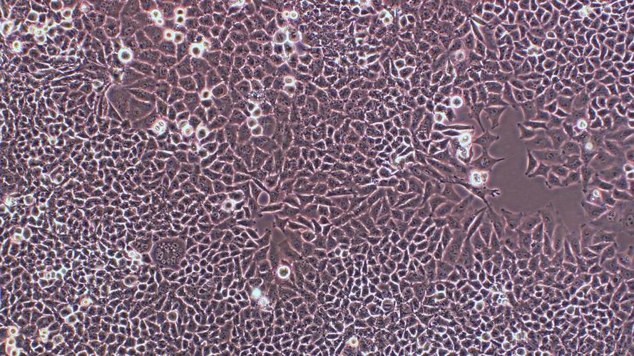 人胃癌细胞mgc-803