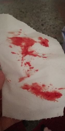 孕期鼻子老是出血,就像这样的,不疼不痒,有的时候比这更多,不