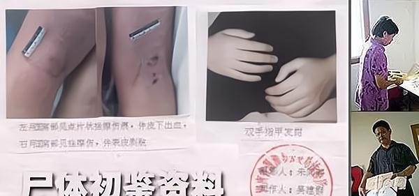 黄静裸死案回顾:6次尸检扑朔迷离,男友:我只是边缘性行为!