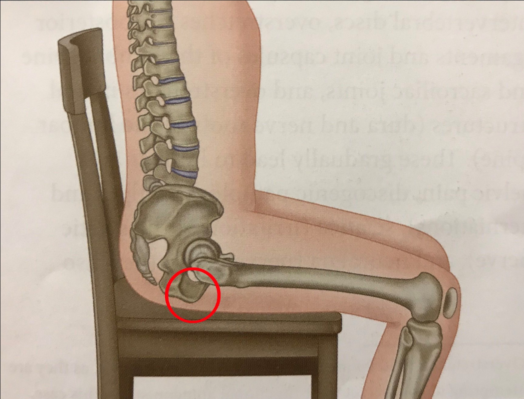 人体的坐骨到底在哪里?