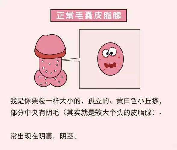 在男性的阴囊和阴茎体上常常会有很多正常的毛囊皮脂腺,但就因为这些