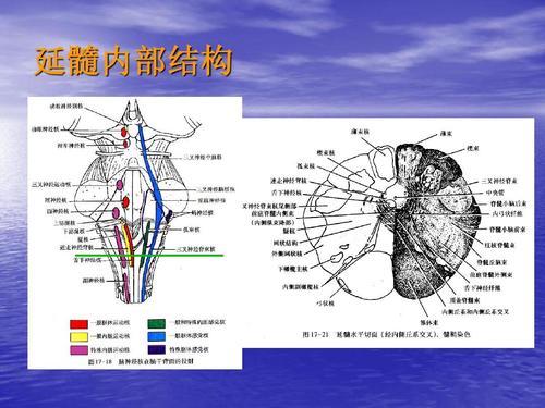 延髓病变讨论ppt