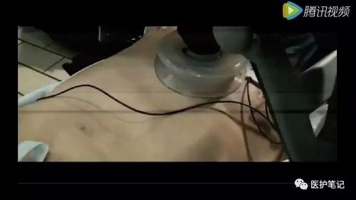 最伟大的心脏骤停现场急救视频--堪称好莱坞大片