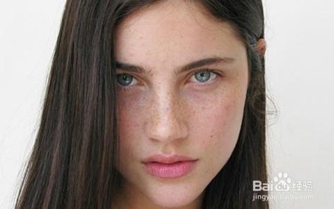 什么是晒斑/脸上一晒太阳就长斑就是晒斑吗