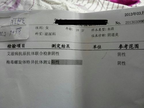 一般会有一段潜伏期才会出现症状,下面学路网小编告诉你梅毒潜伏期有