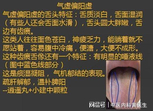 舌头边缘有齿痕印就一定是湿气重吗