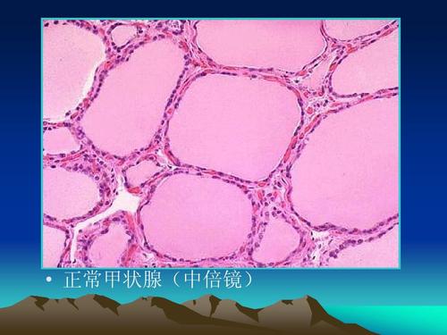 病理学  来自温州医学院仅供参考   正常甲状腺(中倍镜)