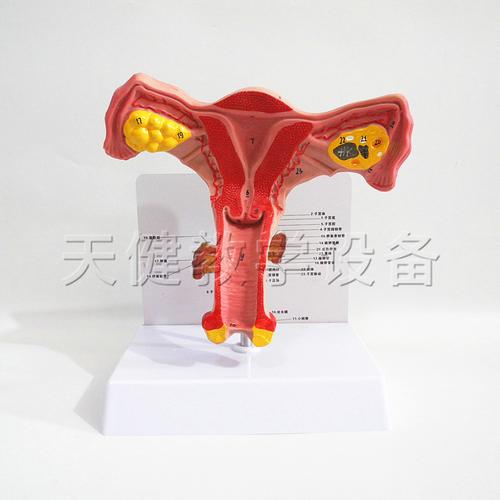 双侧卵巢解剖子宫模型正常子宫模型生殖教学模型