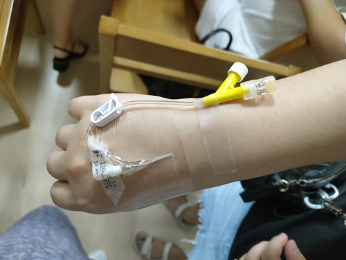 写美篇静脉留置针是临床输液治疗的常用工具,留置针的规范固定是静疗