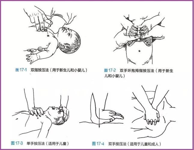 最后,让大家看一个出自第九版《儿科学》的儿童心肺复苏图片,下一次